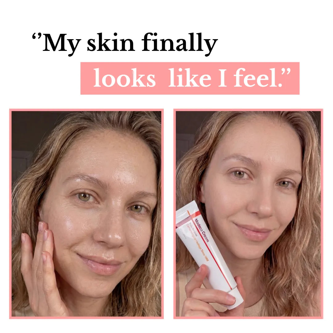 Korael Cream - Dewy Skin